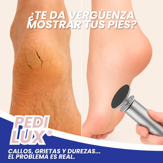 Pedilux™ Removedor de callos eléctrico.