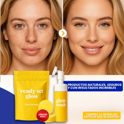 SkinGlow™ Set aclarante a base de cúrcuma y ácido kójico, Elimina manchas visibles desde el 5to día