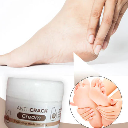 Dile Adiós a la Resequedad y Grietas 🦶🏽 Crema Hidratante
