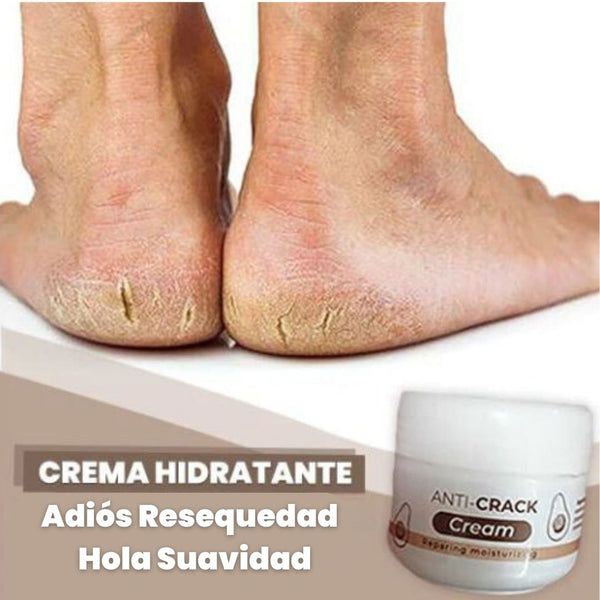 Dile Adiós a la Resequedad y Grietas 🦶🏽 Crema Hidratante